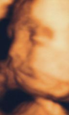 妊娠7ヶ月 胎児 エコー 画像　女の子