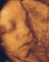 妊娠8ヶ月 胎児 エコー 画像　女の子