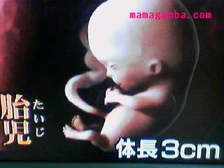 胎児大きさ3cm